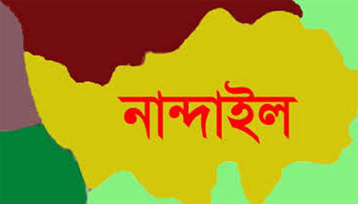 পালিয়ে বিয়েকে কেন্দ্র করে প্রেমিকের চাচাতো ভাইকে কুপিয়ে জখম 